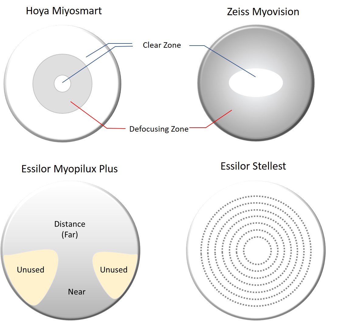 myopia control lens