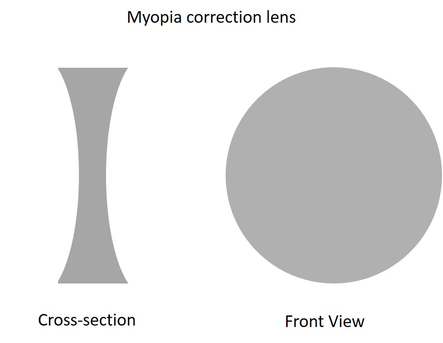myopia lens diagram
